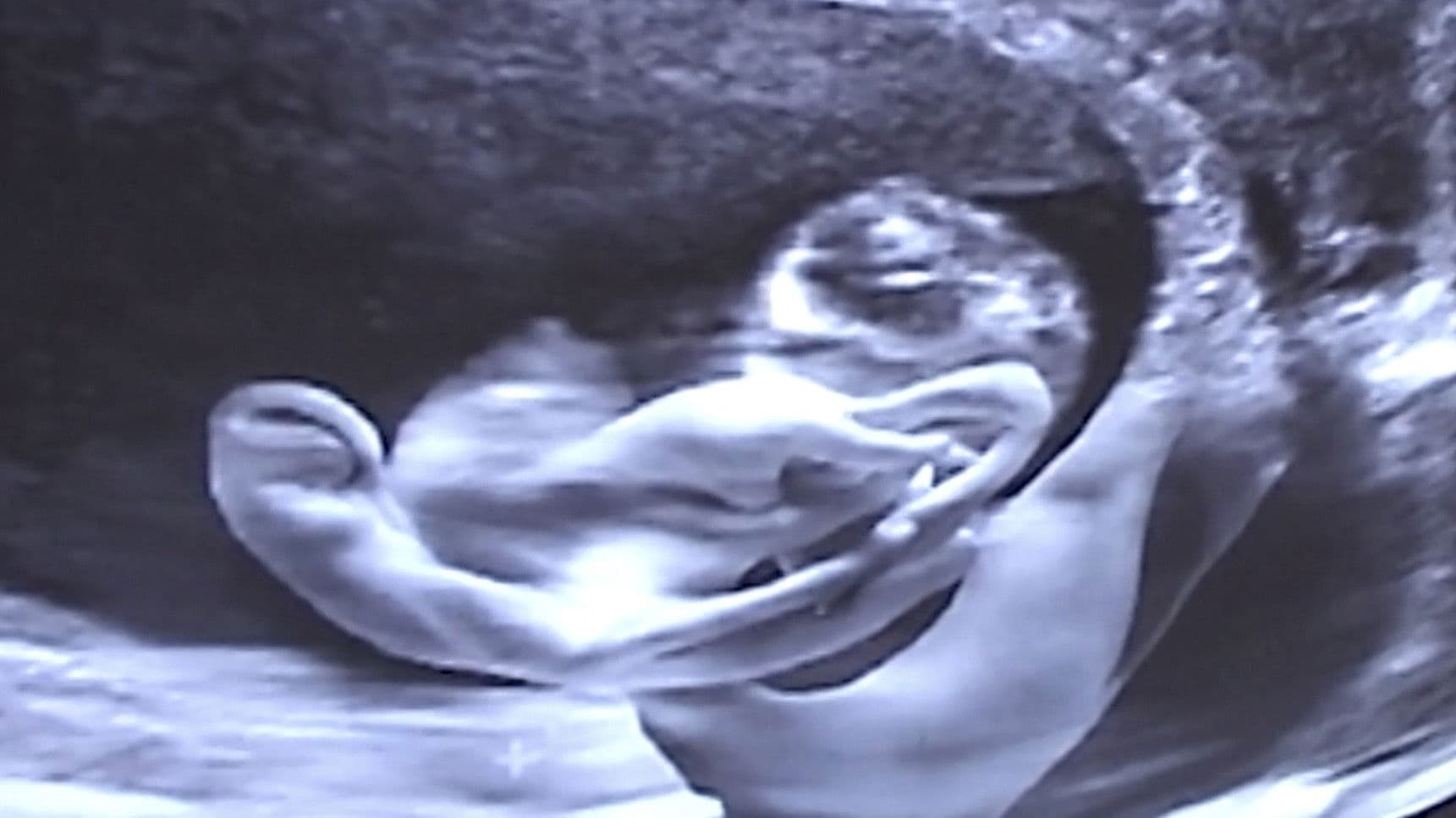 Castration Movie Anthology iii. Year of the Hyaena