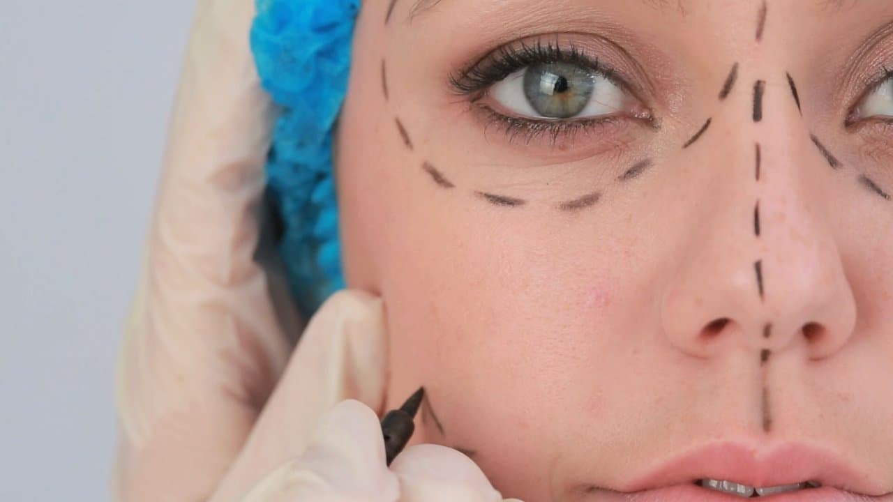 Plastic Surgery Knifemares