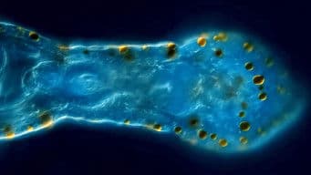 Aeolosoma: Polka-Dotted Vacuum Worms