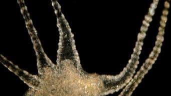 The Beautiful, Brutal Tentacles of Hydra