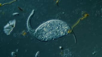 Dileptus: The Toxic Micro Elephant With an Insatiable Appetite